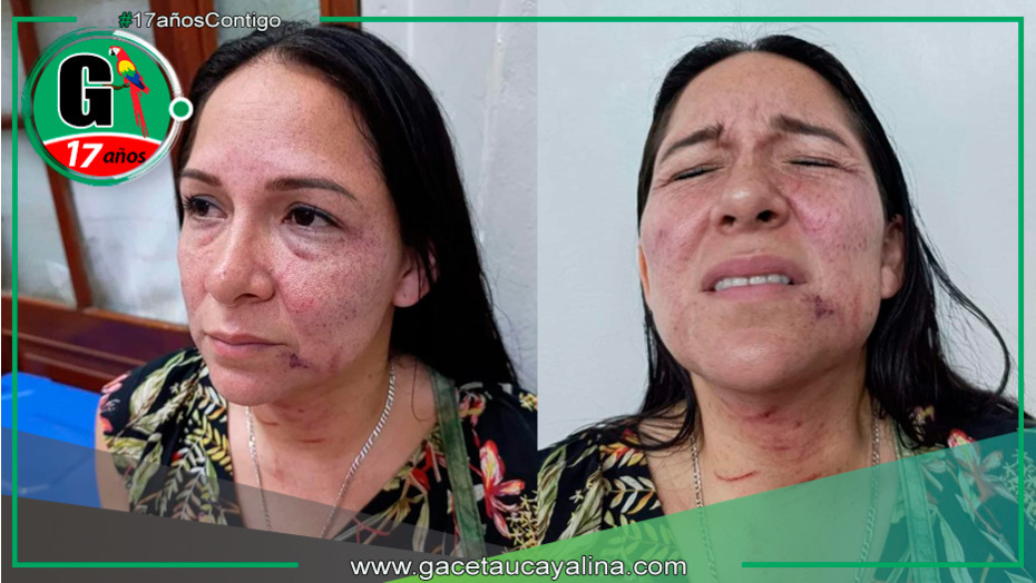 Regidora de Maynas denuncia agresión