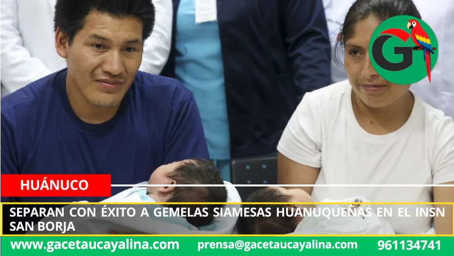 Separan con éxito a gemelas siamesas huanuqueñas en el INSN San Borja