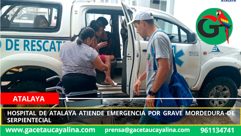 Hospital de Atalaya atiende emergencia por grave mordedura de serpiente